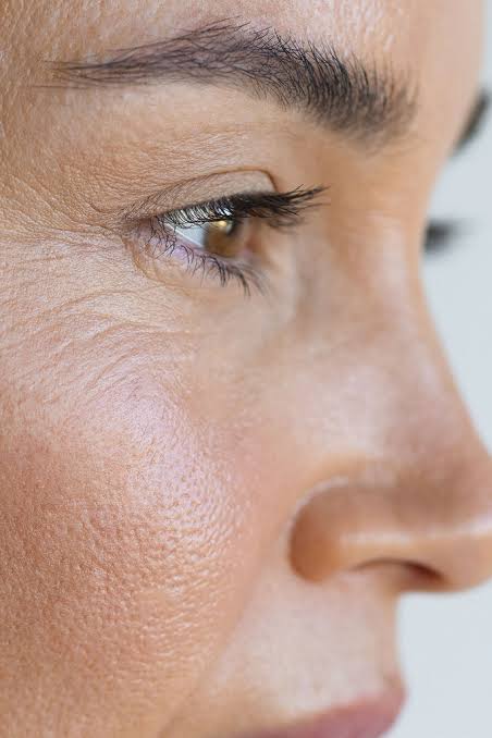 Fine Lines & Wrinkles